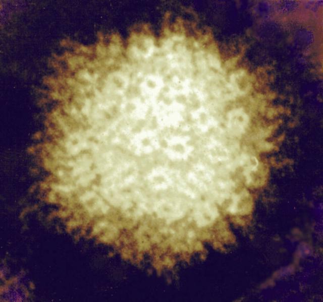 대상포진 바이러스 zoster virus의 현미경적 사진